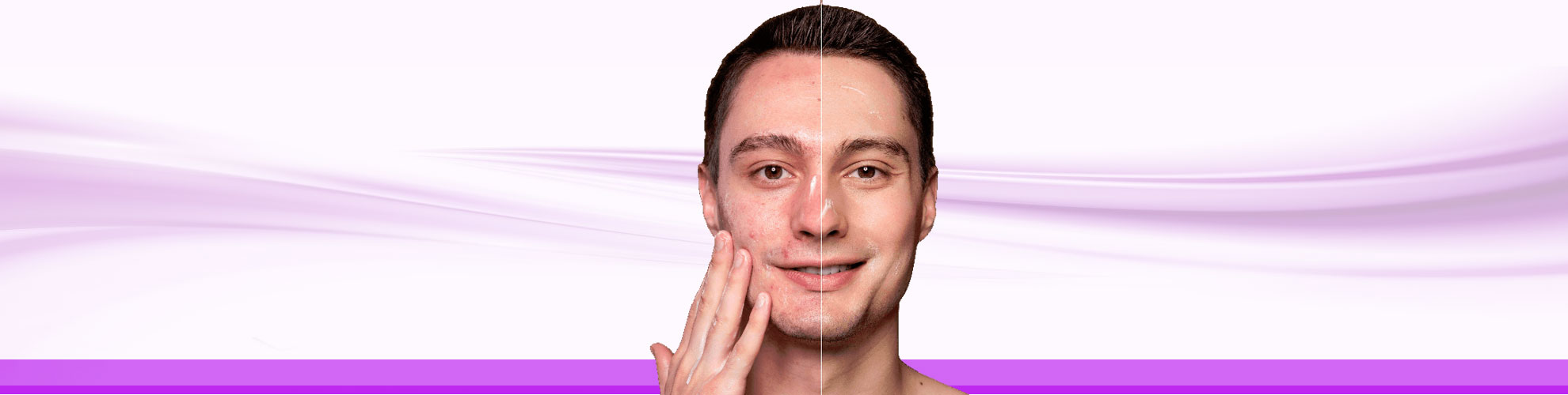 IMeso Needling Non Surgical Rejuvenation Clinic In Toronto, Markham, Richmond Hill