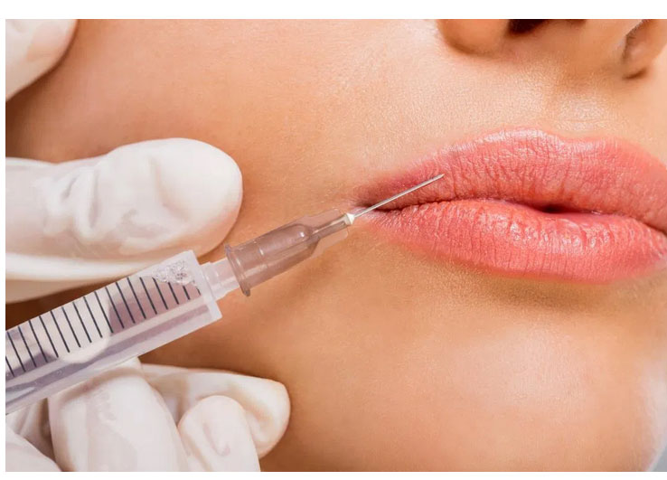 What are dermal fillers?