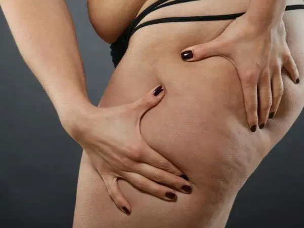 What are the benefits and risks of liposuction?
