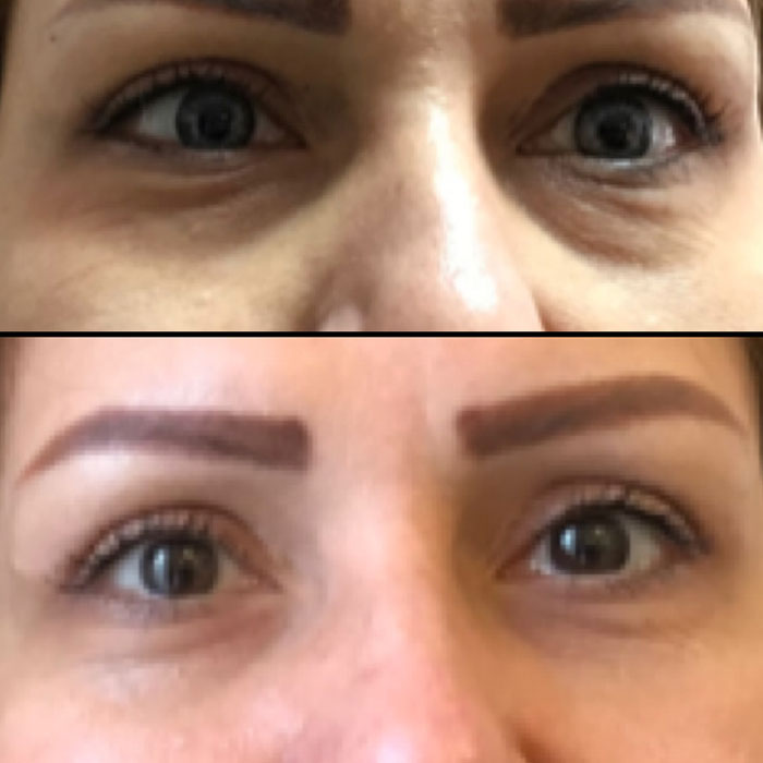 Woodbine Cosmetic Clinic Botox Injection
