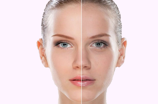 Botox® Injection clinic Toronto