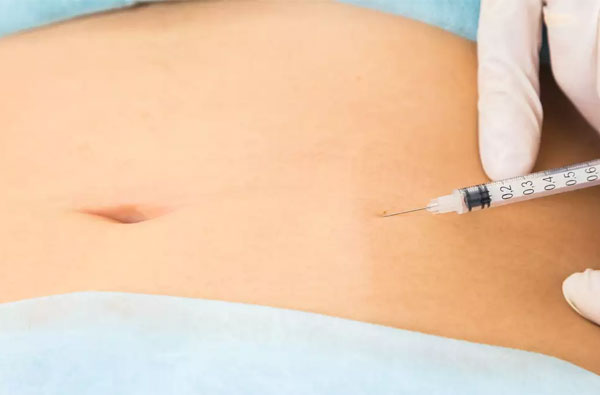 injection lipolysis procedure