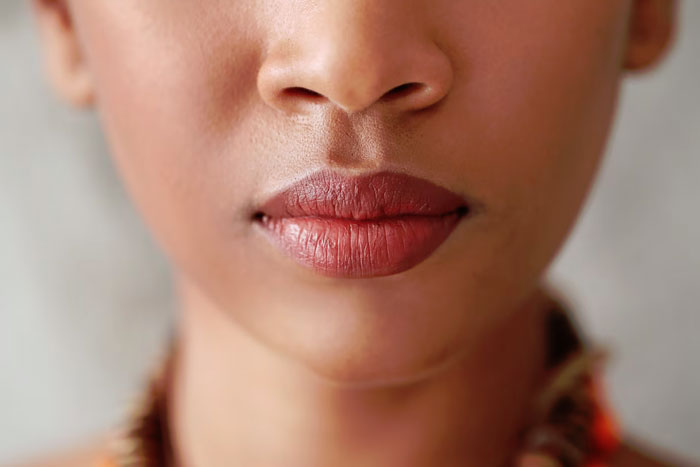 Lip Fillers & Injections Toronto